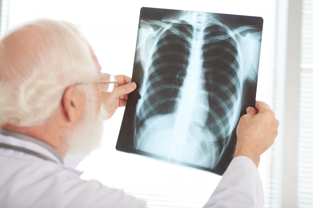 Pacientes com doença pulmonar obstrutiva crônica podem usar o FGTS para o tratamento