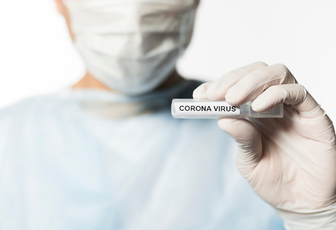 exame diagn&oacute;stico coronav&iacute;rus