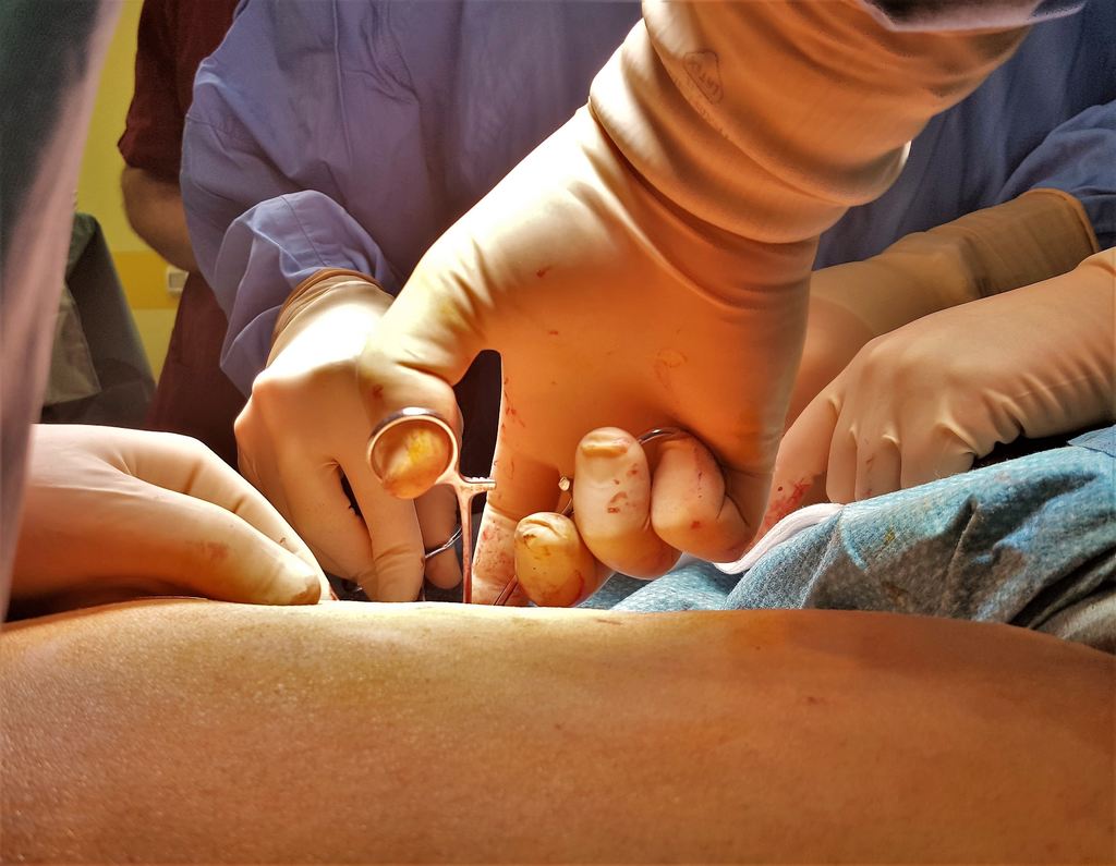 Descubra se o seu plano de saúde cobre a cirurgia para endometriose: saiba mais aqui!